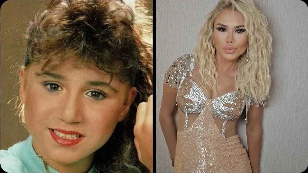 Şarkıcı Ceylan'dan estetik itirafı: Yüzüm artık kaldırmıyor